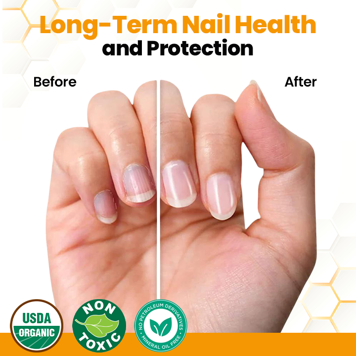 LIMETOW® BeeVenom Anti-Fungal Nail Renewal Oil