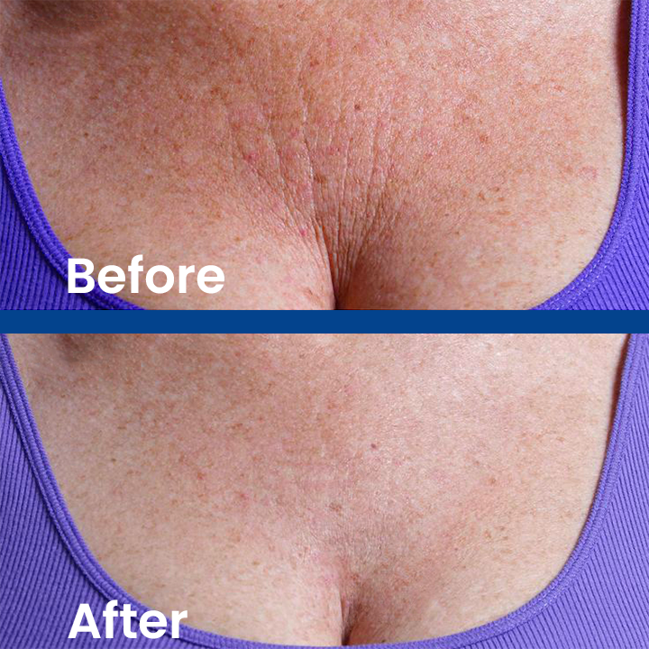 LIMETOW™ Luxe Collagen Firming Cream