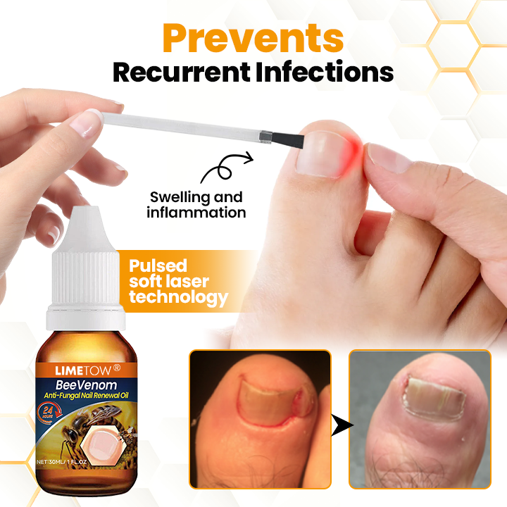 LIMETOW® BeeVenom Anti-Fungal Nail Renewal Oil