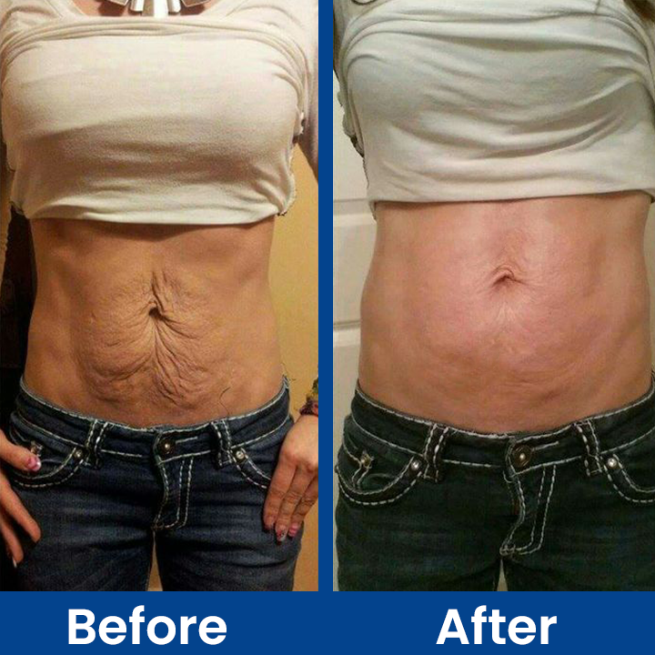 LIMETOW™ Luxe Collagen Firming Cream
