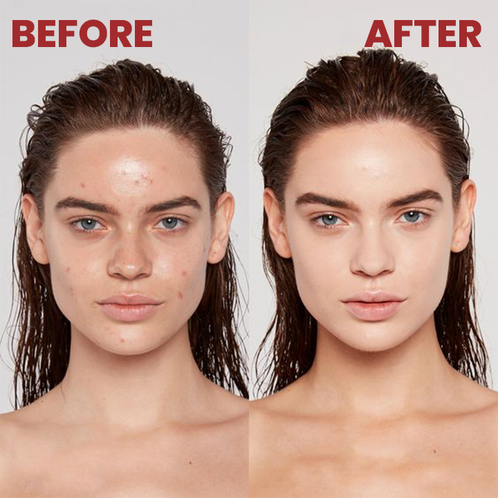 LIMETOW® CC Correction Cream