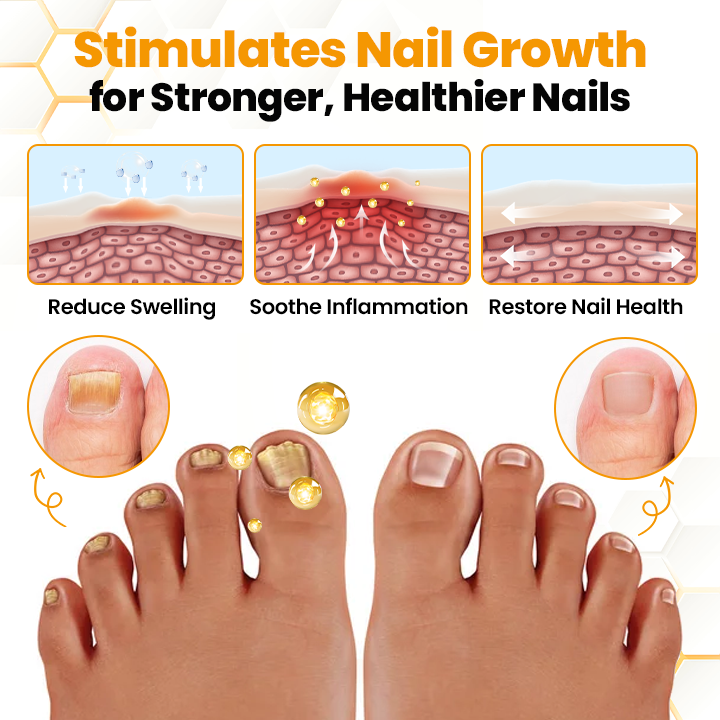 LIMETOW® BeeVenom Anti-Fungal Nail Renewal Oil