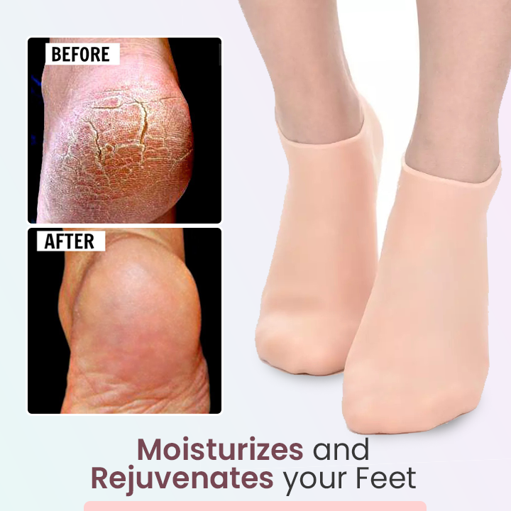 LIMETOW™ Silicone Moisturizing Socks