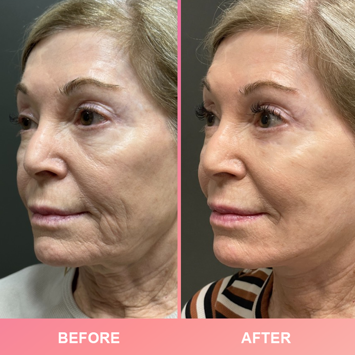 Official Store👉Made and Shipped from USA✨LIMETOW™ Compact Anti-wrinkle Bar💝LAST DAY 50%OFF