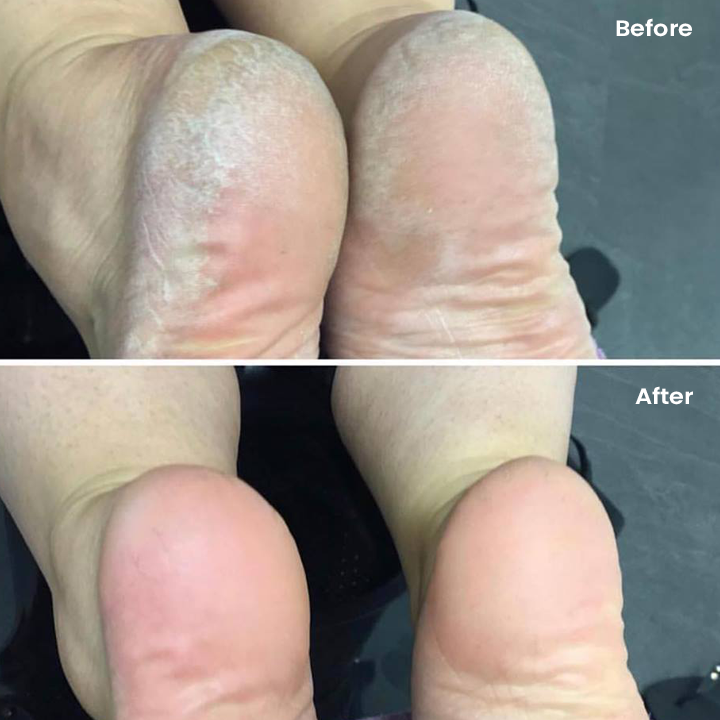 LIMETOW™ Silicone Moisturizing Socks
