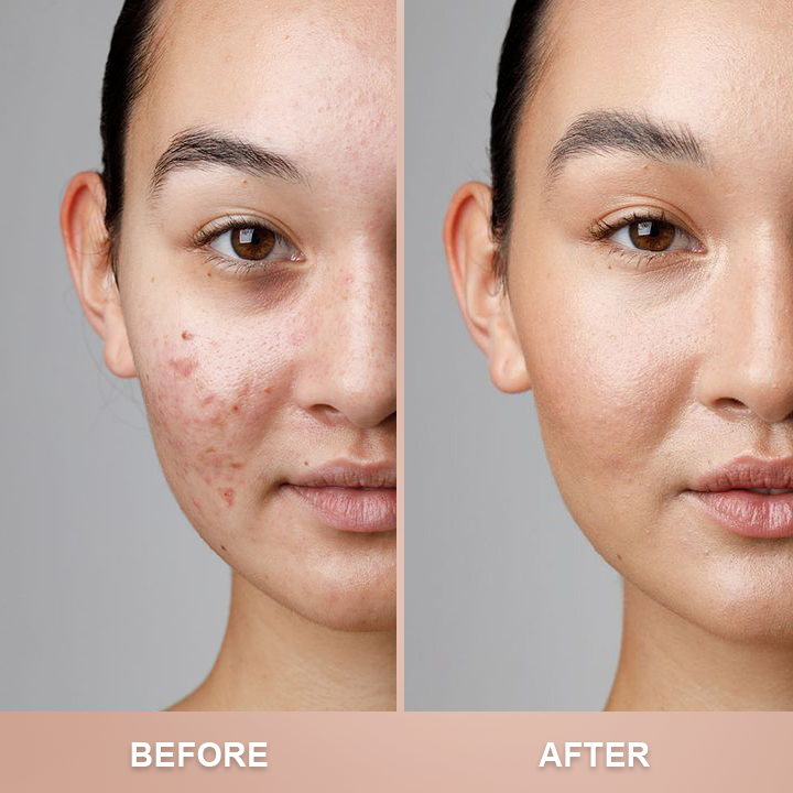 ⏰Limited Time Offer⏰Foundation 4 in 1-Medium Spectrum