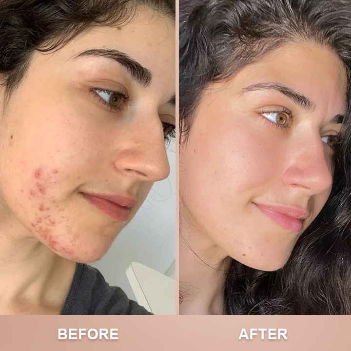 ⏰Limited Time Offer⏰Foundation 4 in 1-Medium Spectrum