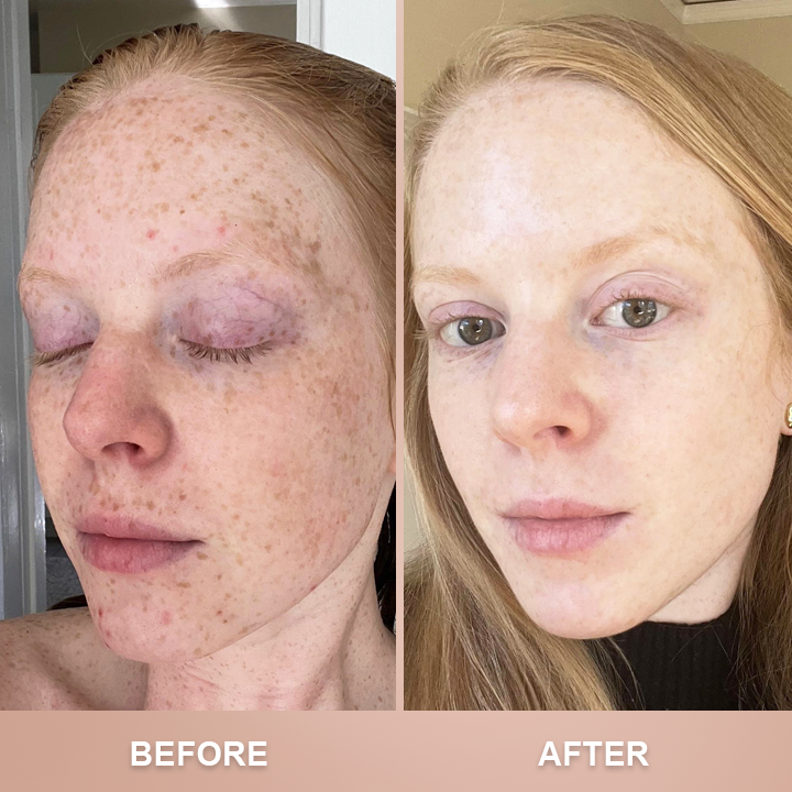 ⏰Limited Time Offer⏰Foundation 4 in 1-Medium Spectrum