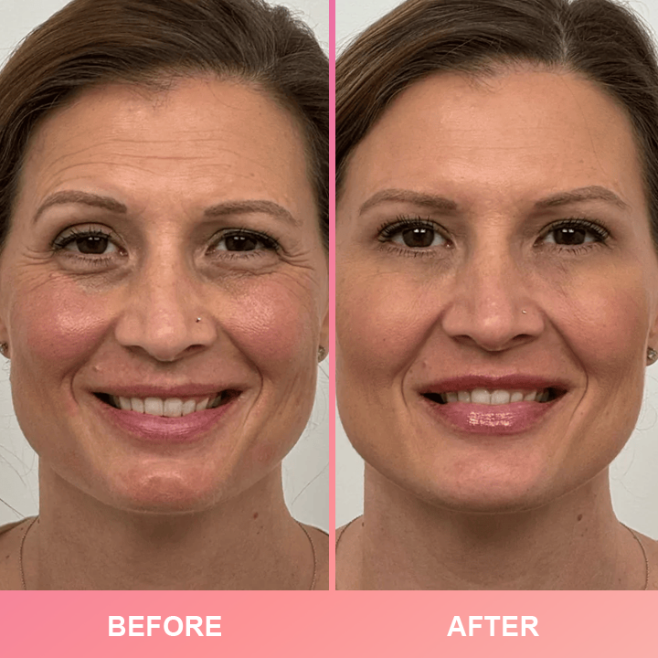 Official Store👉Made and Shipped from USA✨LIMETOW™ Compact Anti-wrinkle Bar💝LAST DAY 50%OFF