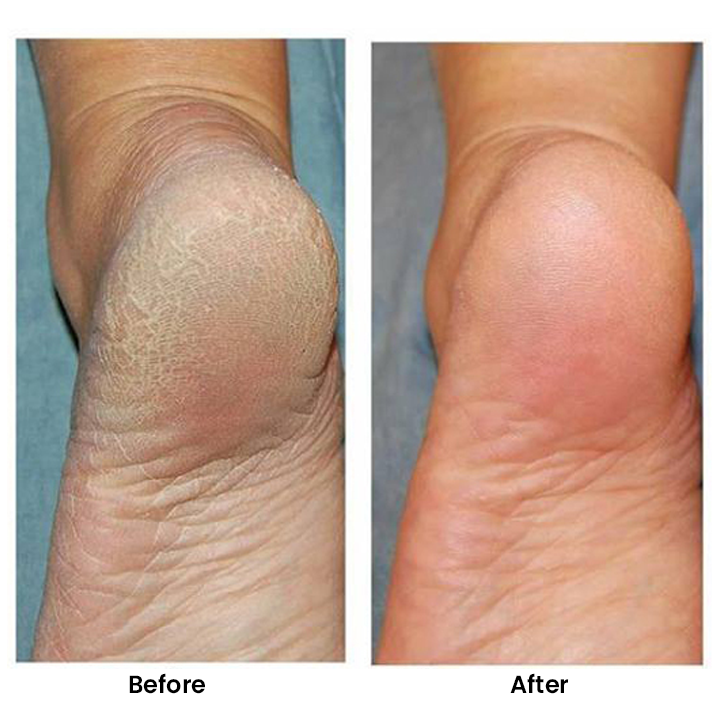 LIMETOW™ Silicone Moisturizing Socks