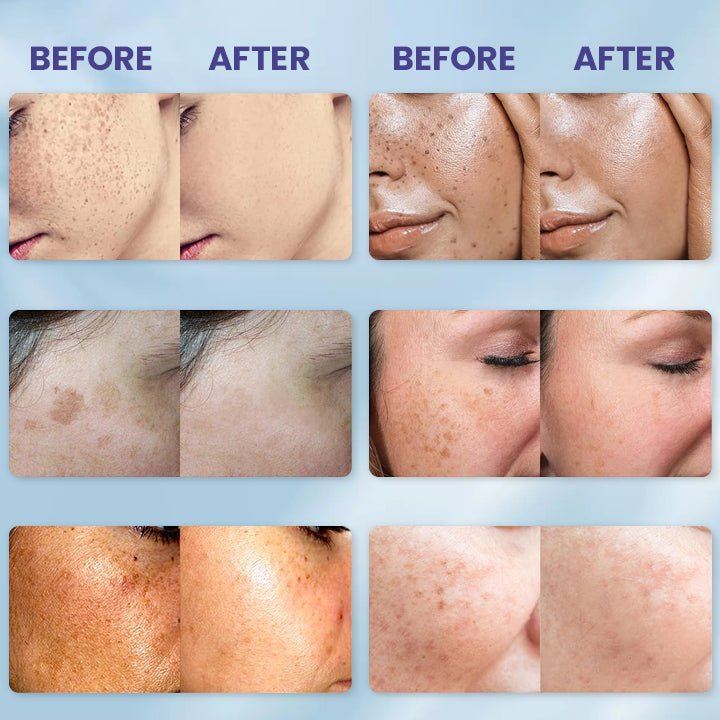 LIMETOW™ Niacinamide Brightening & Freckle Fade Essence