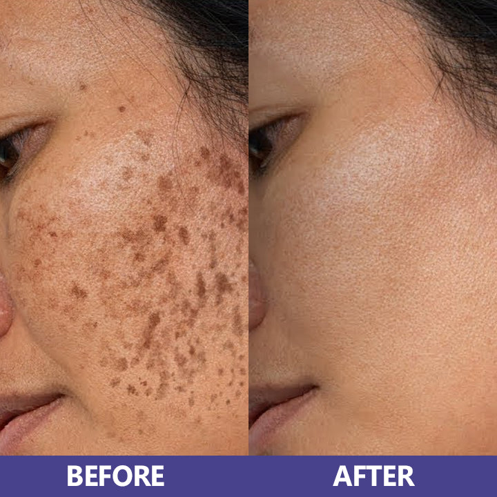 LIMETOW™ Niacinamide Brightening & Freckle Fade Essence