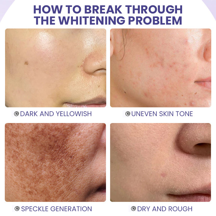 LIMETOW™ Niacinamide Brightening & Freckle Fade Essence