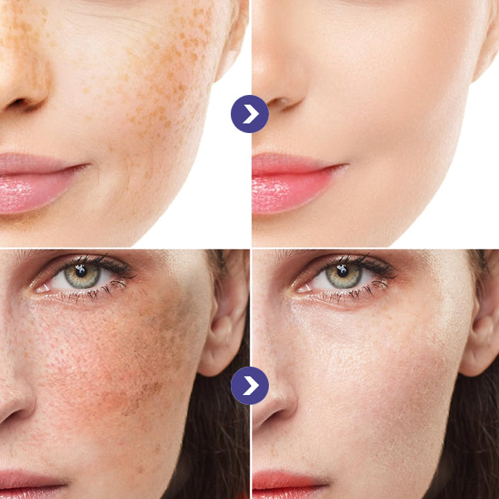 LIMETOW™ Niacinamide Brightening & Freckle Fade Essence