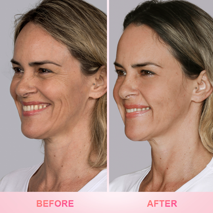 LIMETOW® Wrinkle Bounce Multi Balm