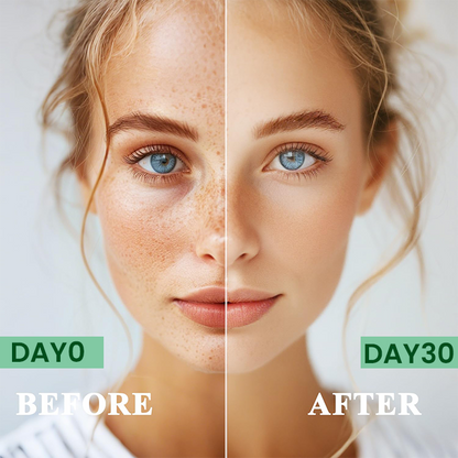 Made and Shipped from USA✨LIMETOW® Anti-freckle essence🌿