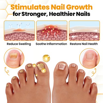 LIMETOW® BeeVenom Anti-Fungal Nail Renewal Oil