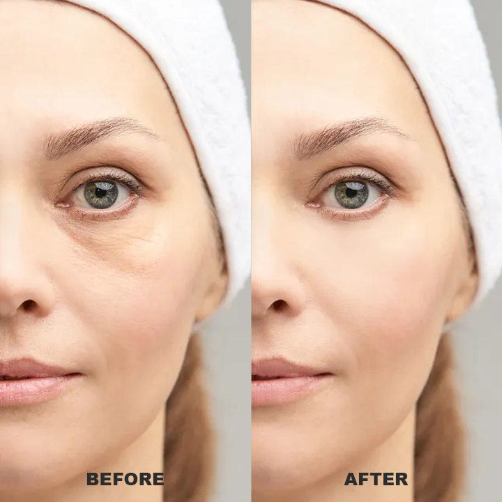 👨‍⚕️💐Made and Shipped from USA✨LIMETOW™ Under Eye Puffiness Remover💝LAST DAY 50%OFF