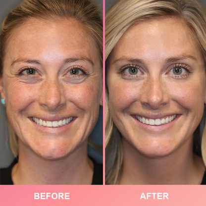 Official Store: LIMETOW™ Compact Anti-Wrinkle Bar