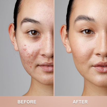 ⏰Limited Time Offer⏰Foundation 4 in 1-Medium Spectrum