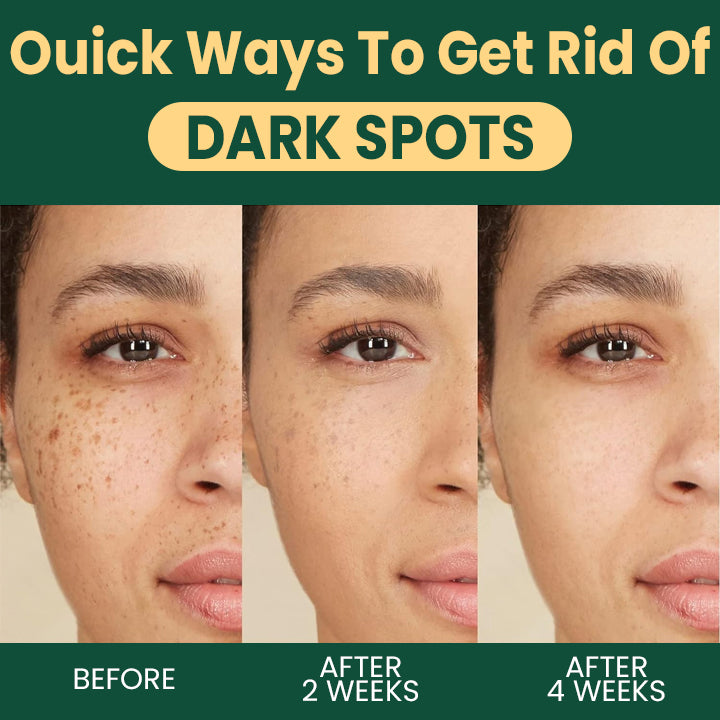 LIMETOW™ Alpha Arbutin Brightening Lotion