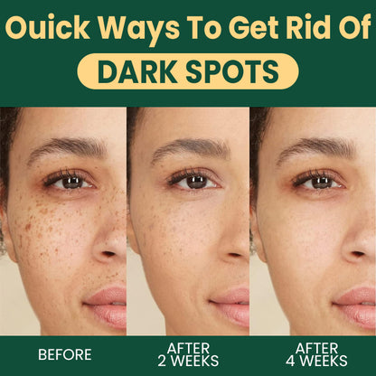 LIMETOW™ Alpha Arbutin Brightening Lotion