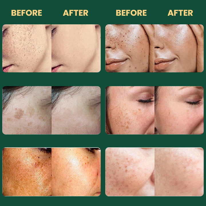 LIMETOW™ Alpha Arbutin Brightening Lotion