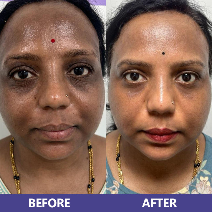LIMETOW™ Niacinamide Brightening & Freckle Fade Essence
