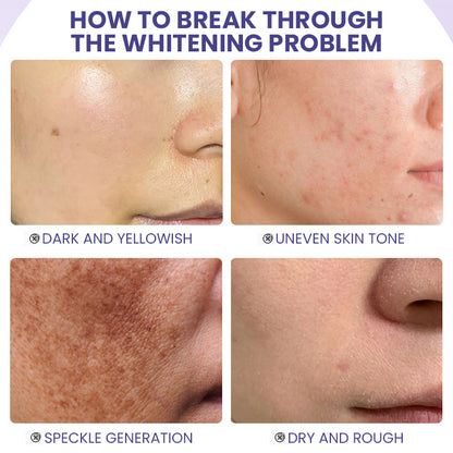 LIMETOW™ Niacinamide Brightening & Freckle Fade Essence