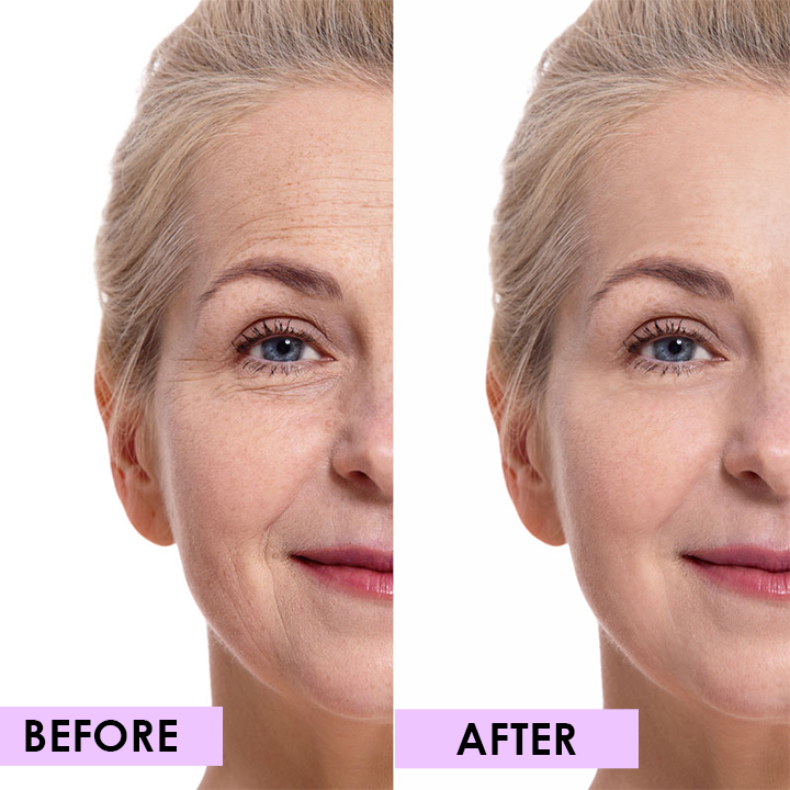 LIMETOW™ Anti-Wrinkle Magic Strips