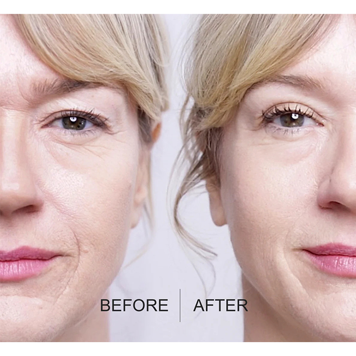 LIMETOW™ Anti-Wrinkle Magic Strips