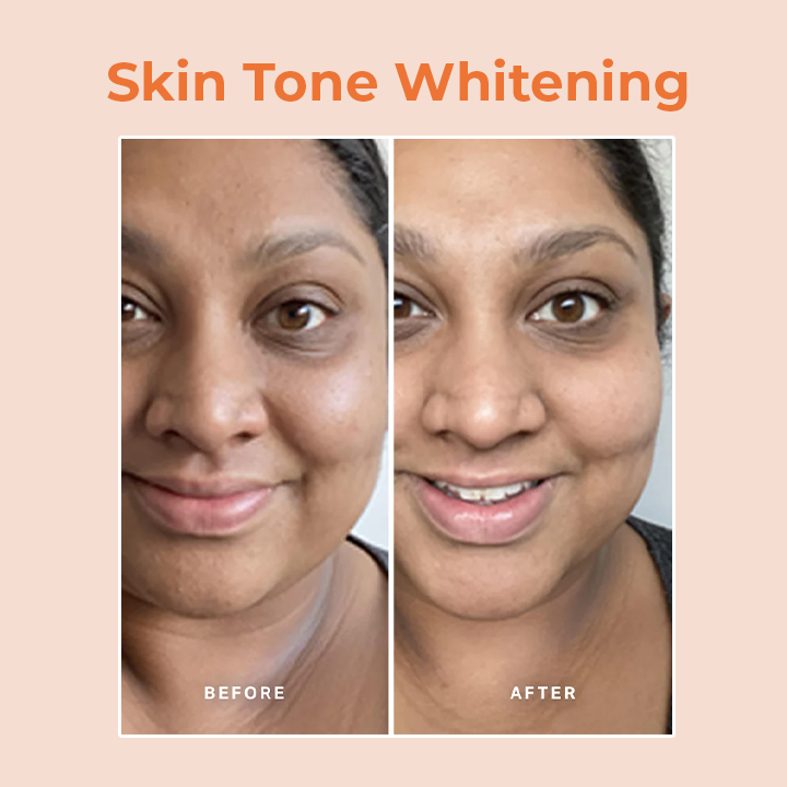 LIMETOW™ Papaya Whitening Deep Exfoliator