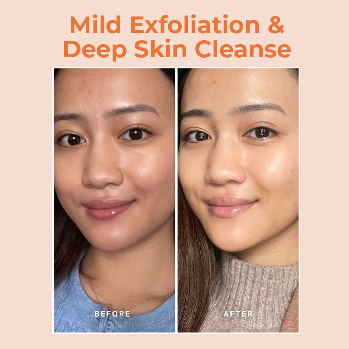 LIMETOW™ Papaya Whitening Deep Exfoliator