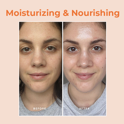 LIMETOW™ Papaya Whitening Deep Exfoliator